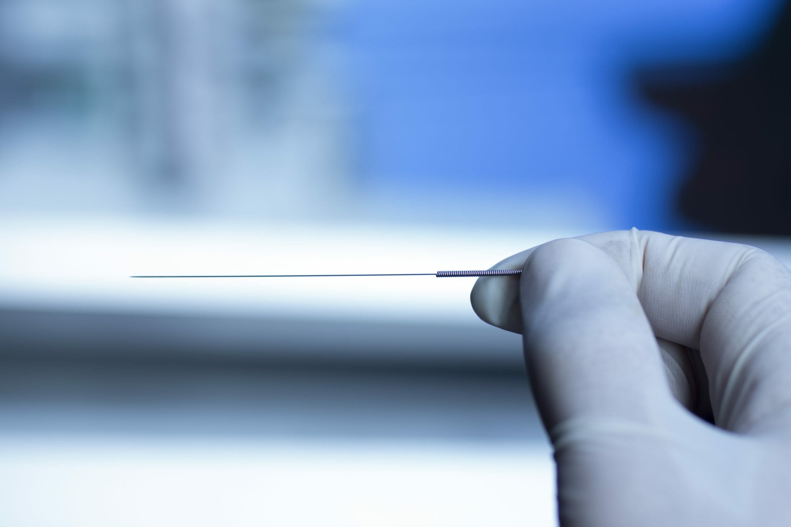 All About Dry Needling