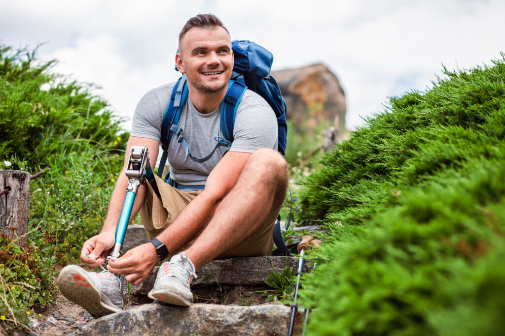 Man with amputated leg going on a hike