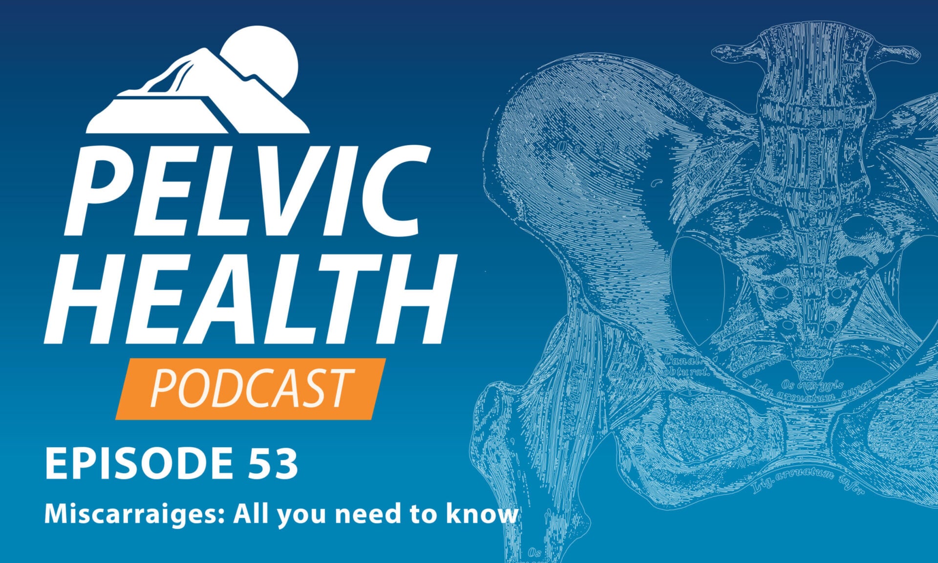 Miscarriages: All you need to know