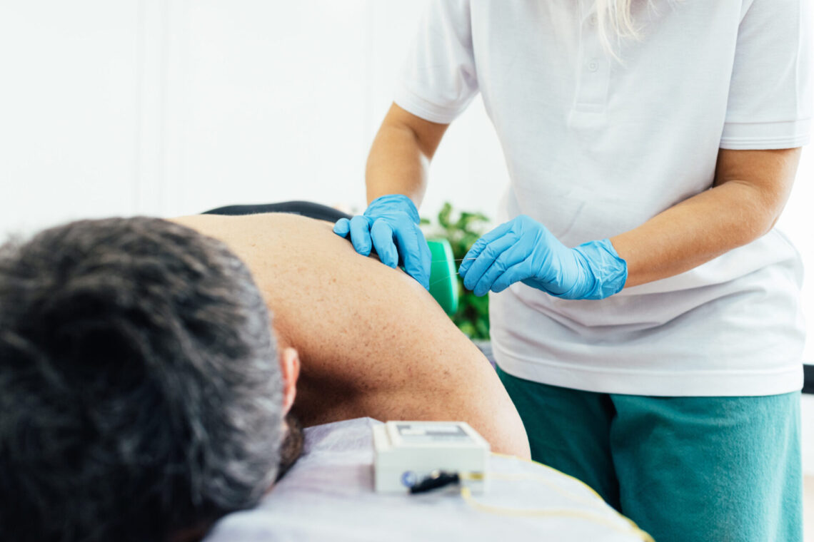 Physiotherapist giving back therapy to a patient at the clinic. Dry needling treatment to relieve muscle pain.